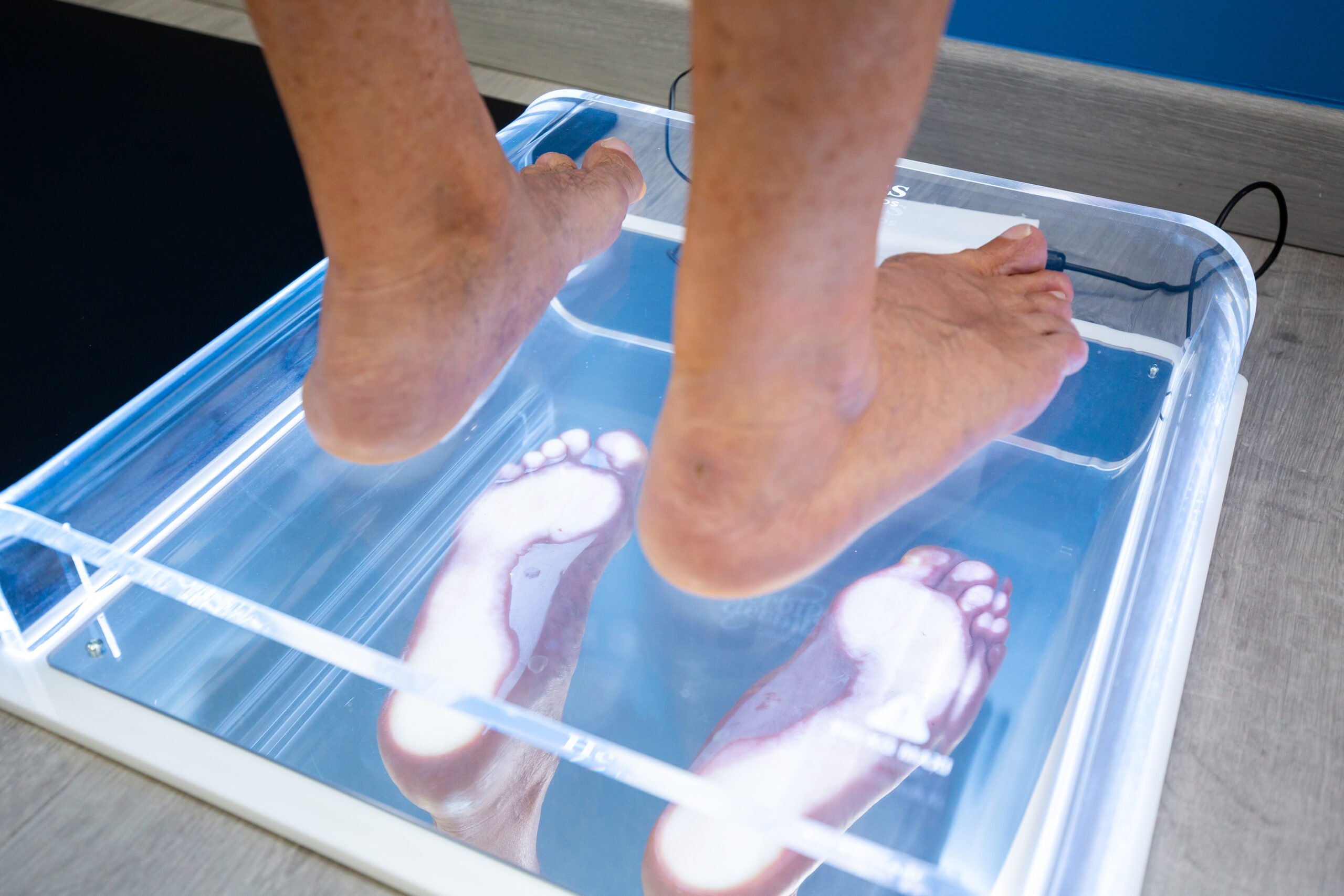 Estudio biométrico en Clínica Podológica en Benidorm y Dénia